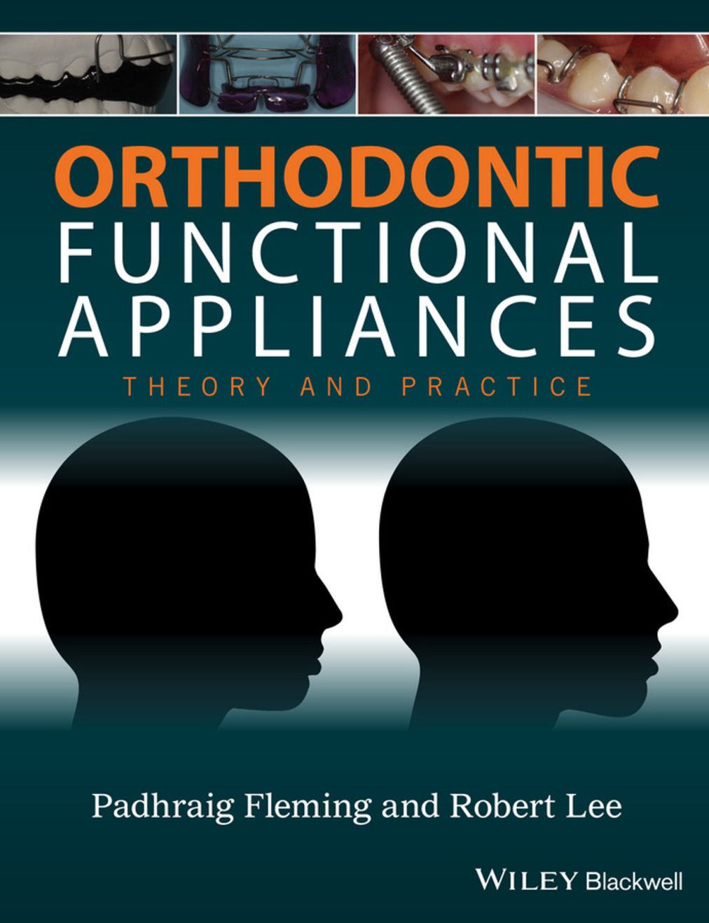 Orthodontic Functional Appliances