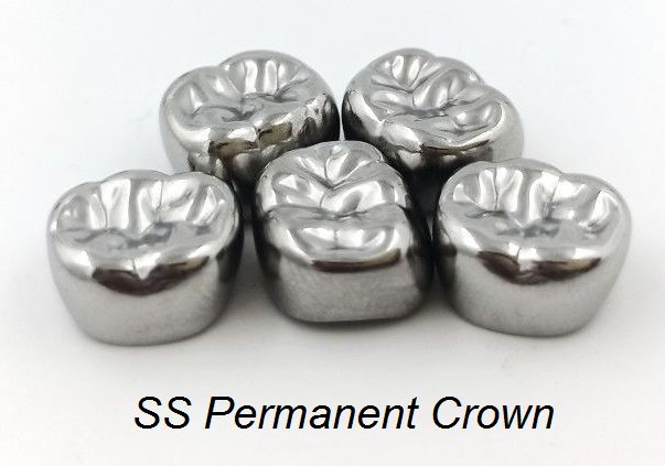Permanent SS Crown