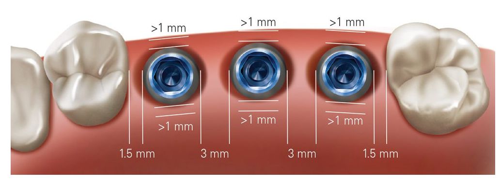 M-D Positioning Guide