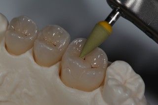 Porcelain &amp; Zirconia Grinding &amp; Polishing