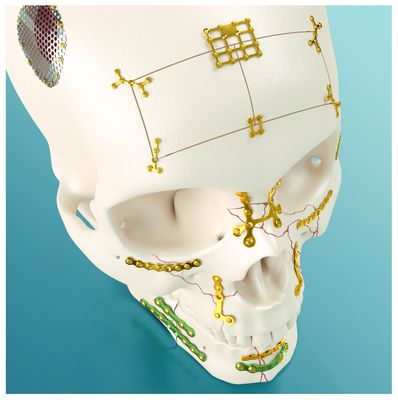 Mini Plate &amp; screw