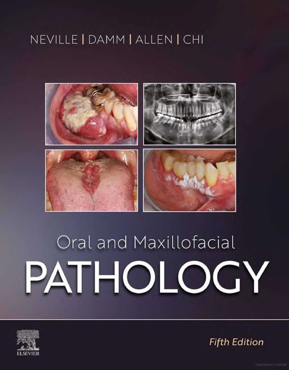 Oral and Maxillofcial Pathology