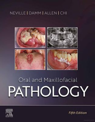 Oral and Maxillofcial Pathology