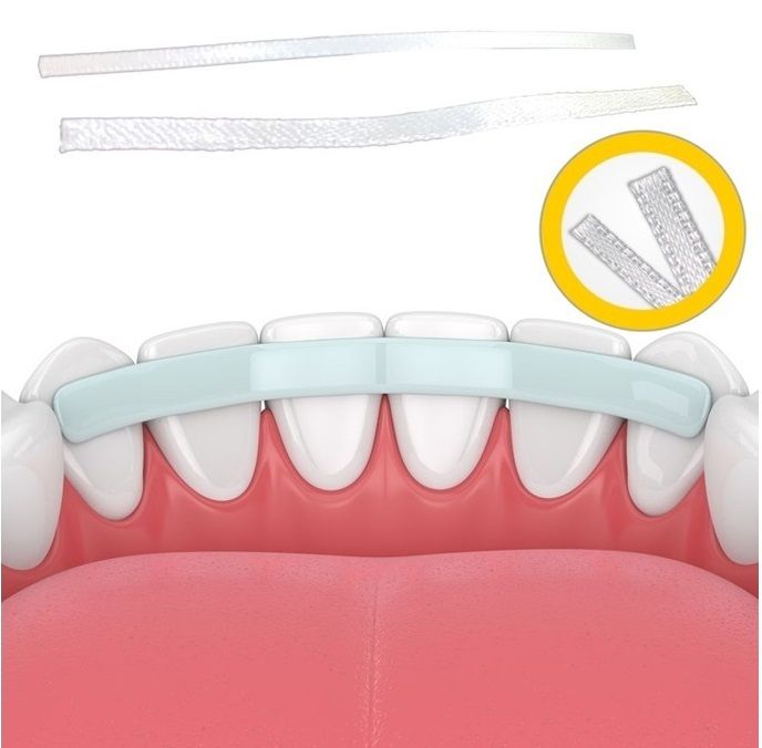 Glass Fiber Splint Strip