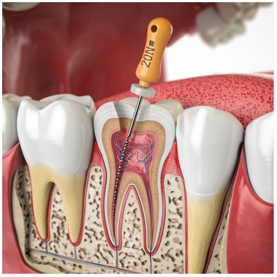 Endodontics