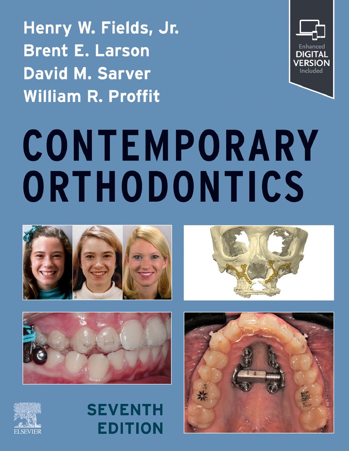 Contemporary Orthodontics