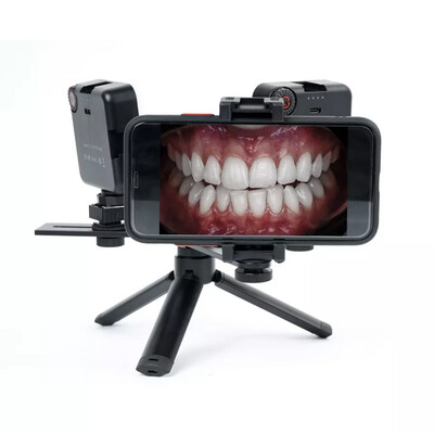 Mobile Dental Photography NO.5