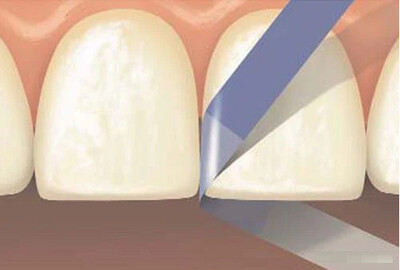 Plastic Finighing &amp; Polishing Strip