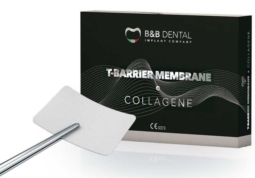 T-Barrier Collagen Membrane