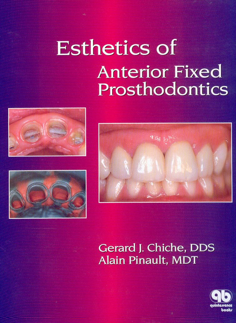 Esthetics of anterior fixed prosthesis