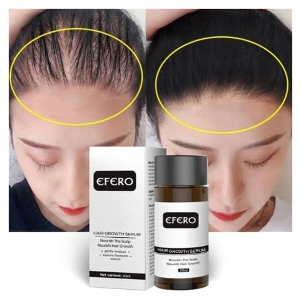 Herbal Hair Growth Serum - 20ml
