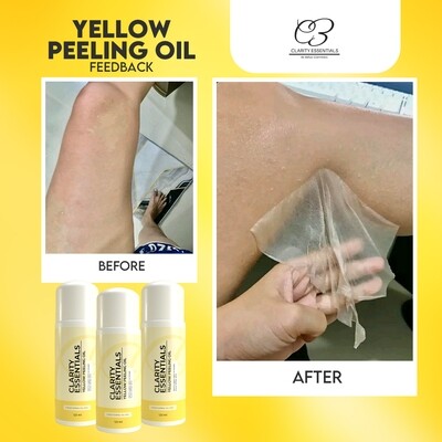 Clarity Essential Yellow Peeling Oil - 30ml, 60ml &amp; 120ml
