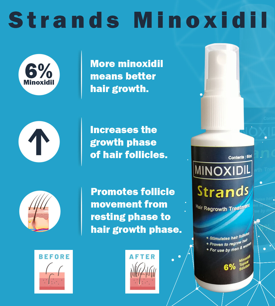 Minoxidil 6% Strands - Hair Grower