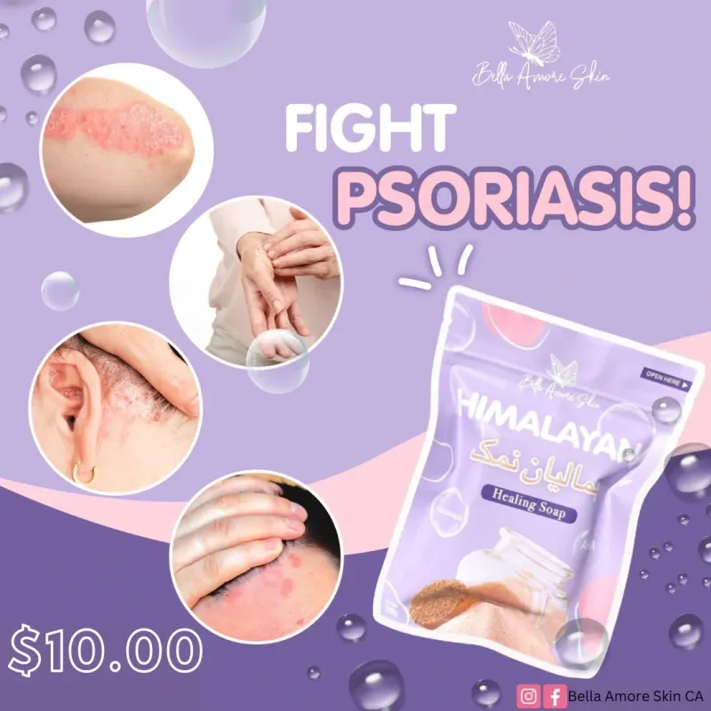 Himalayan Healing Soap by Bella Amore Skin 130g