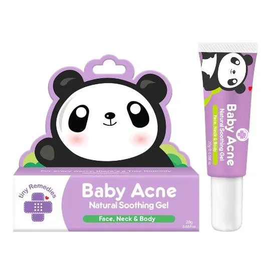 Tiny Buds Baby Naturals Tiny Buds Baby Acne Soothing gel (20g) Tiny Buds Baby Naturals Tiny Buds Baby Acne Soothing gel (20g)