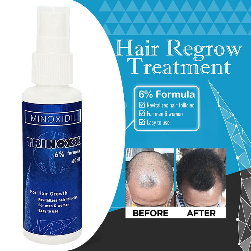 TRINOXX 6% Minoxidil Topical Solution for Men and Women 30ml