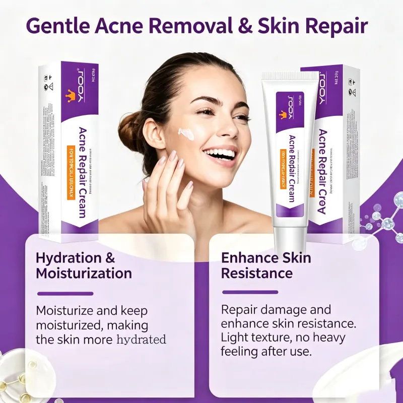 YOOJ Acne Repair Cream Oil Control Pore Minimizing &amp; Skin Brightening Daily Face Moisturize
