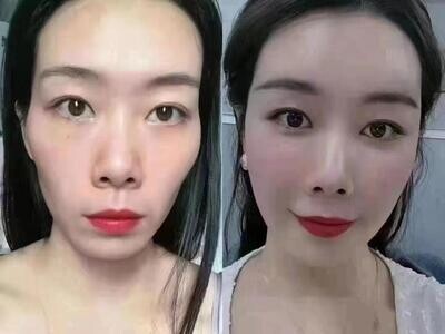 REVERSE AGE TREATMENT