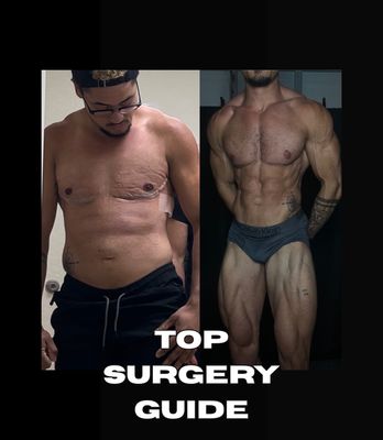 Top Surgery Supply Guide