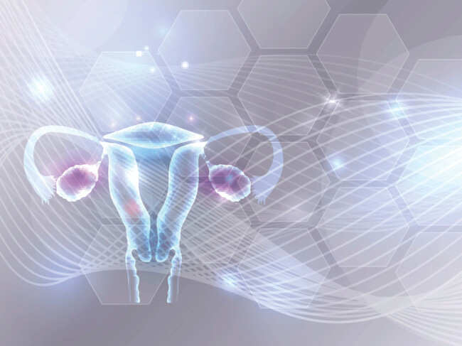 ​Advanced​ Pack for Gynecological Tumors