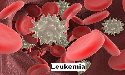 Leukemia Support
