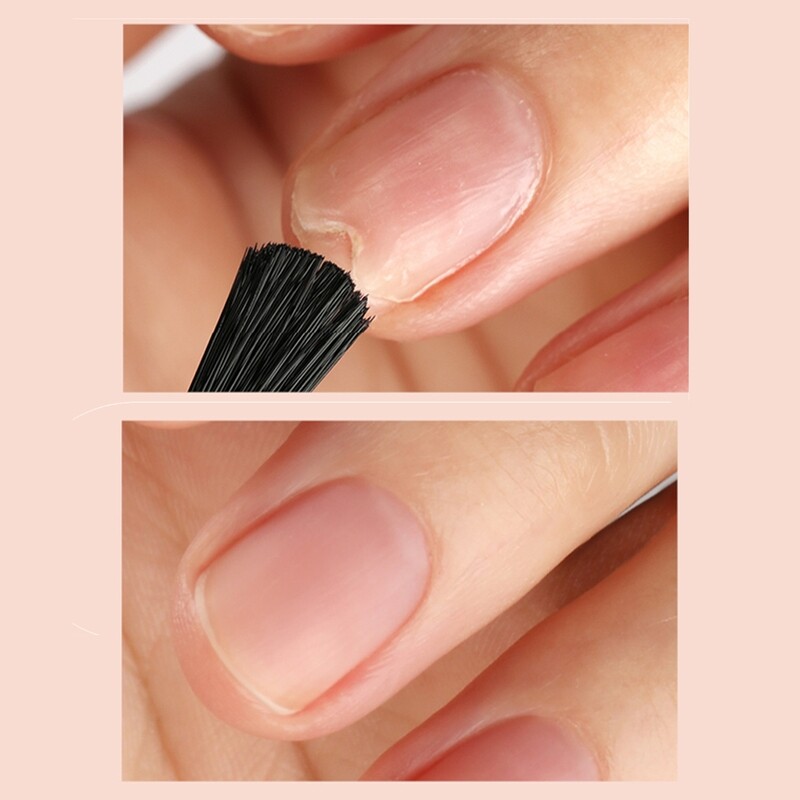 Antifungal – nail growth stimulator, 7ml.