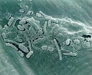 Xanthomonas spp. Detection