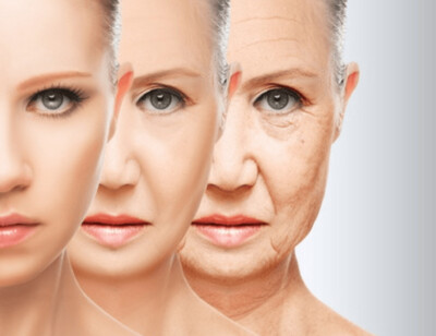 Aging