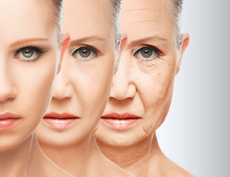 Aging