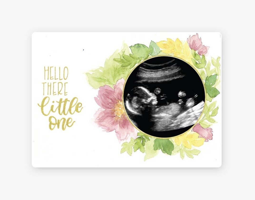 Bloom Baby Magnetic Ultrasound Photo Frame