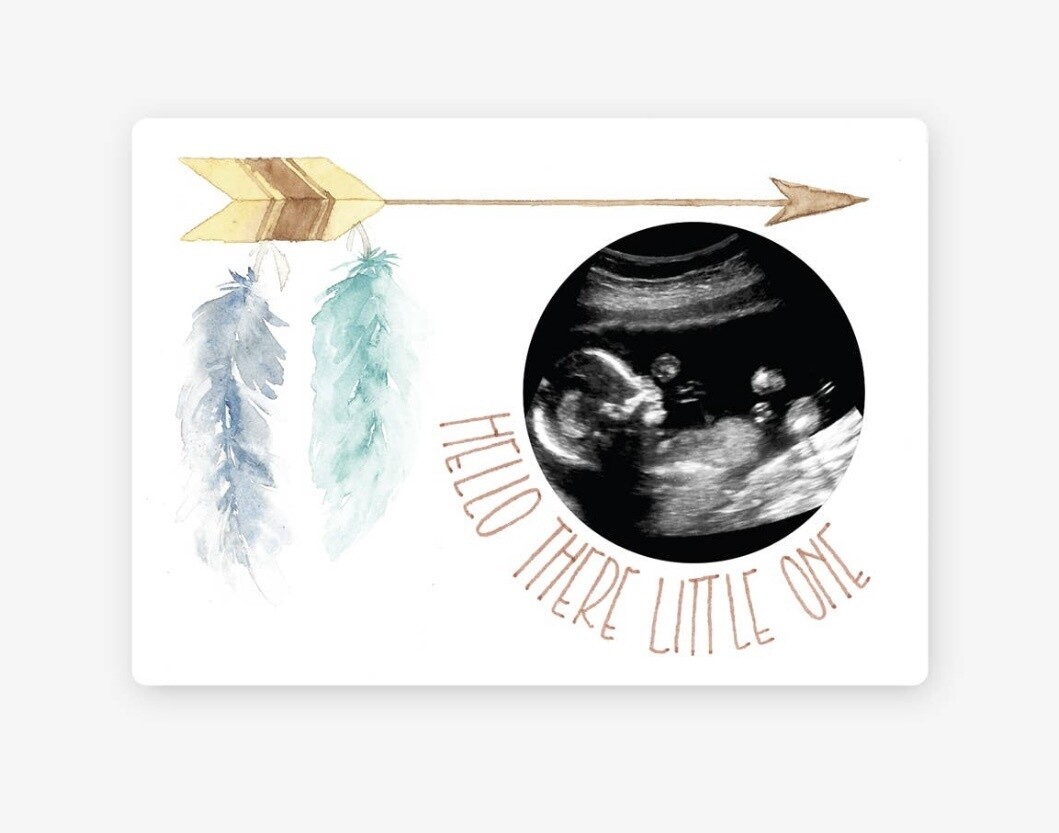 Feather Baby Magnetic Ultrasound Wooden Photo Frame