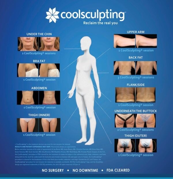 Coolsculpting