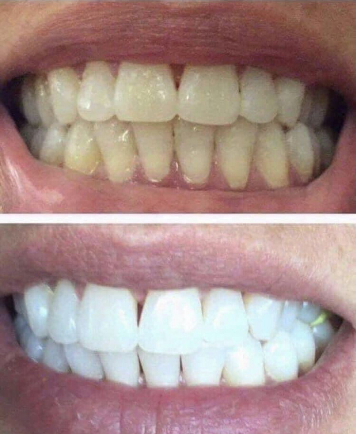 Whitening Toothpaste