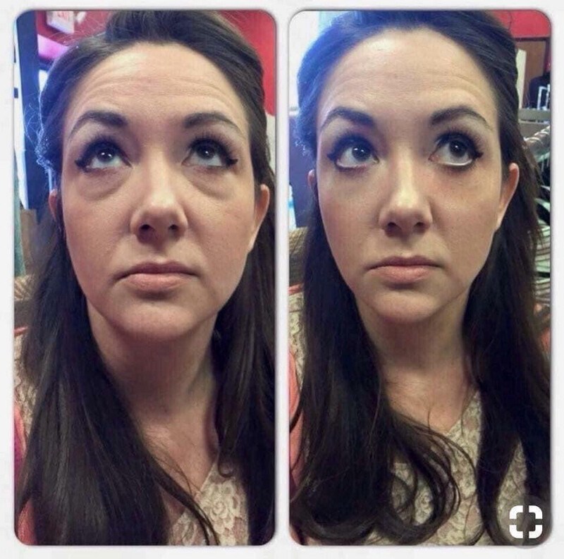 Puffy Eye Cream