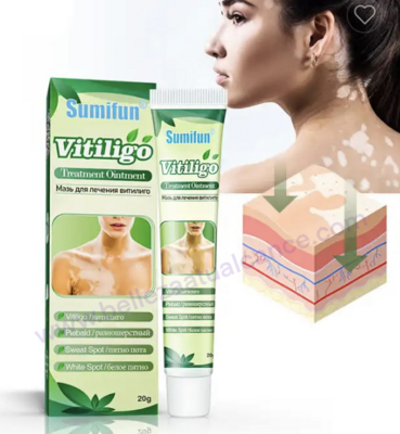 White Tag Treatment Cream for Reduces White Spots Skin & Vitiligo Skin Care Moisturizing External Use Ointment 20G