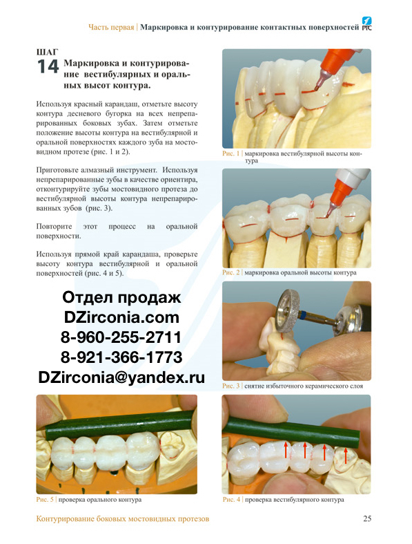 учебное пособие контурирование боковых мостовидных протезов. книги для зубных техников. моделирование анатомической формы зуба из воска. книги для зубных техников. учебное пособие контурирование боковых мостовидных протезов.