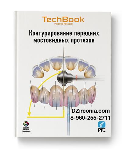 Контурирование керамических протезов передних зубов DZirconia.com 8-960-255-2711 или 8-921-366-1773 DZirconia@yandex.ru