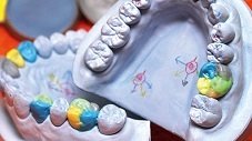 ПЛАНИРУЕТСЯ. ВВЕДЕНИЕ В ГНАТАЛОГИЮ. МОДЕЛИРОВАНИЕ ВОСКОМ ПОВЕРХНОСТЕЙ ЗУБОВ С ИСПОЛЬЗОВАНИЕМ ПЛАНИРУЕТСЯ. ВВЕДЕНИЕ В ГНАТАЛОГИЮ. МОДЕЛИРОВАНИЕ ВОСКОМ ПОВЕРХНОСТЕЙ ЗУБОВ С ИСПОЛЬЗОВАНИЕМ