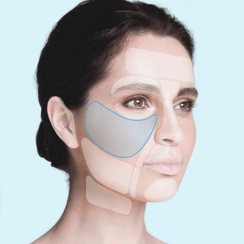 ThreadLift Mid Face