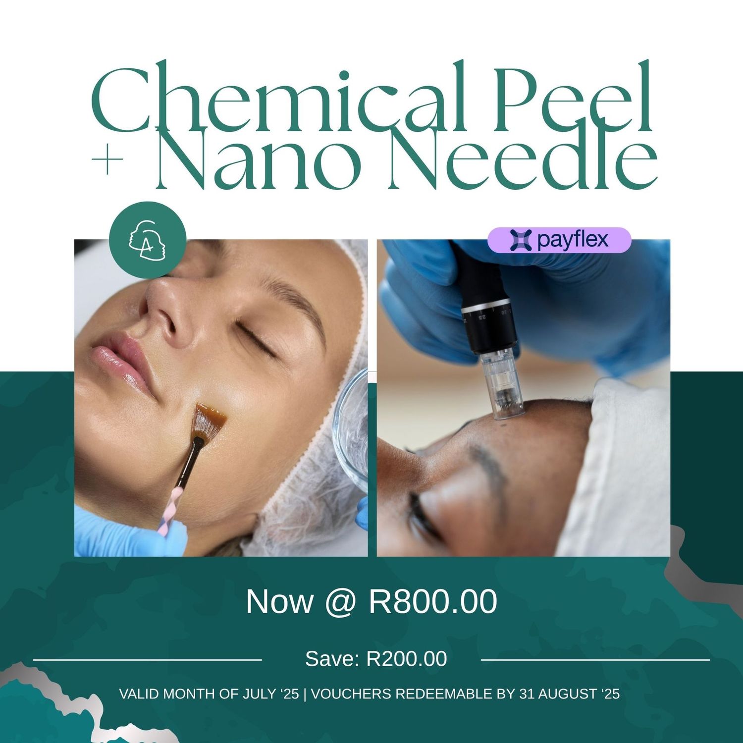 Chemical Peel + Nano Needle Facial