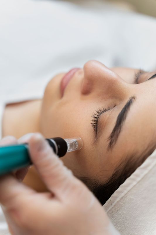 Microneedling Options