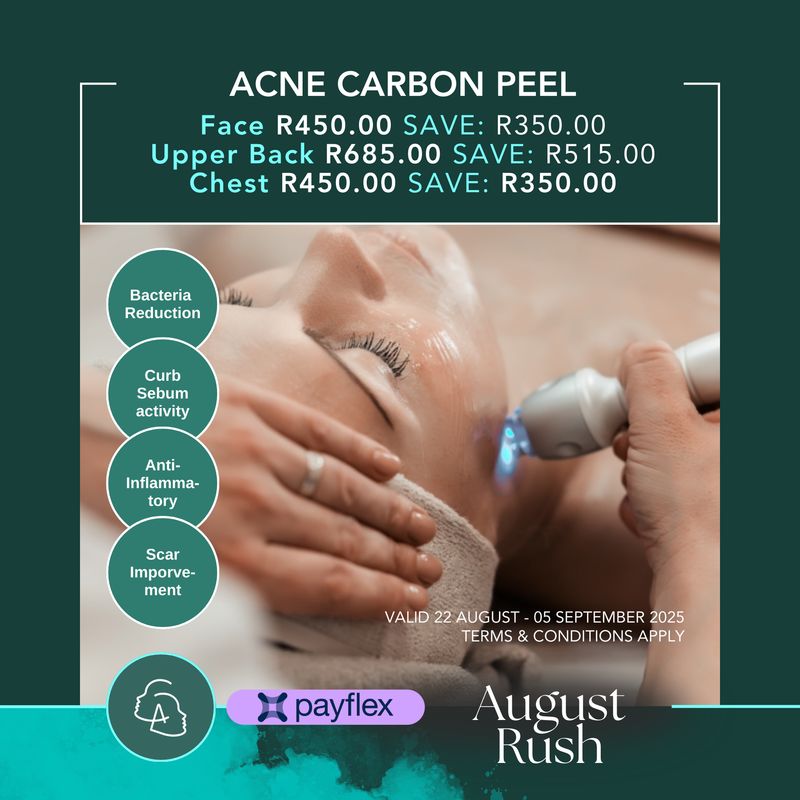 Carbon Peeling Laser Treatment Face Carbon Peeling Laser Treatment Face