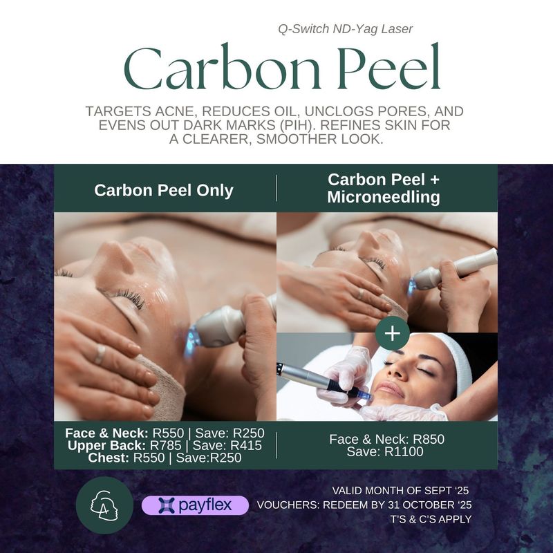 Carbon Peeling Laser Treatment Upper Back Carbon Peeling Laser Treatment Upper Back