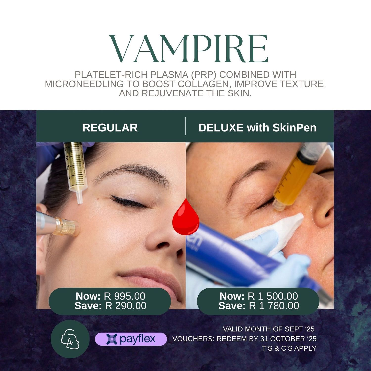 Vampire Deluxe Facial