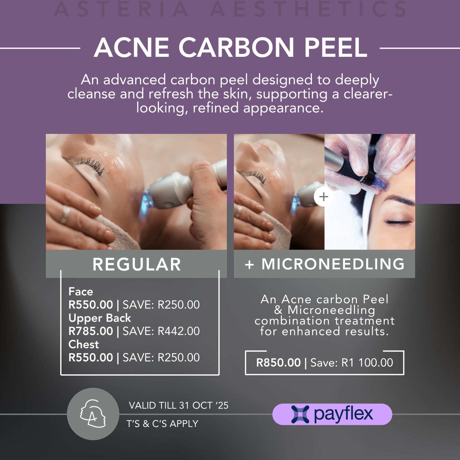 Carbon Peeling Laser Treatment Face