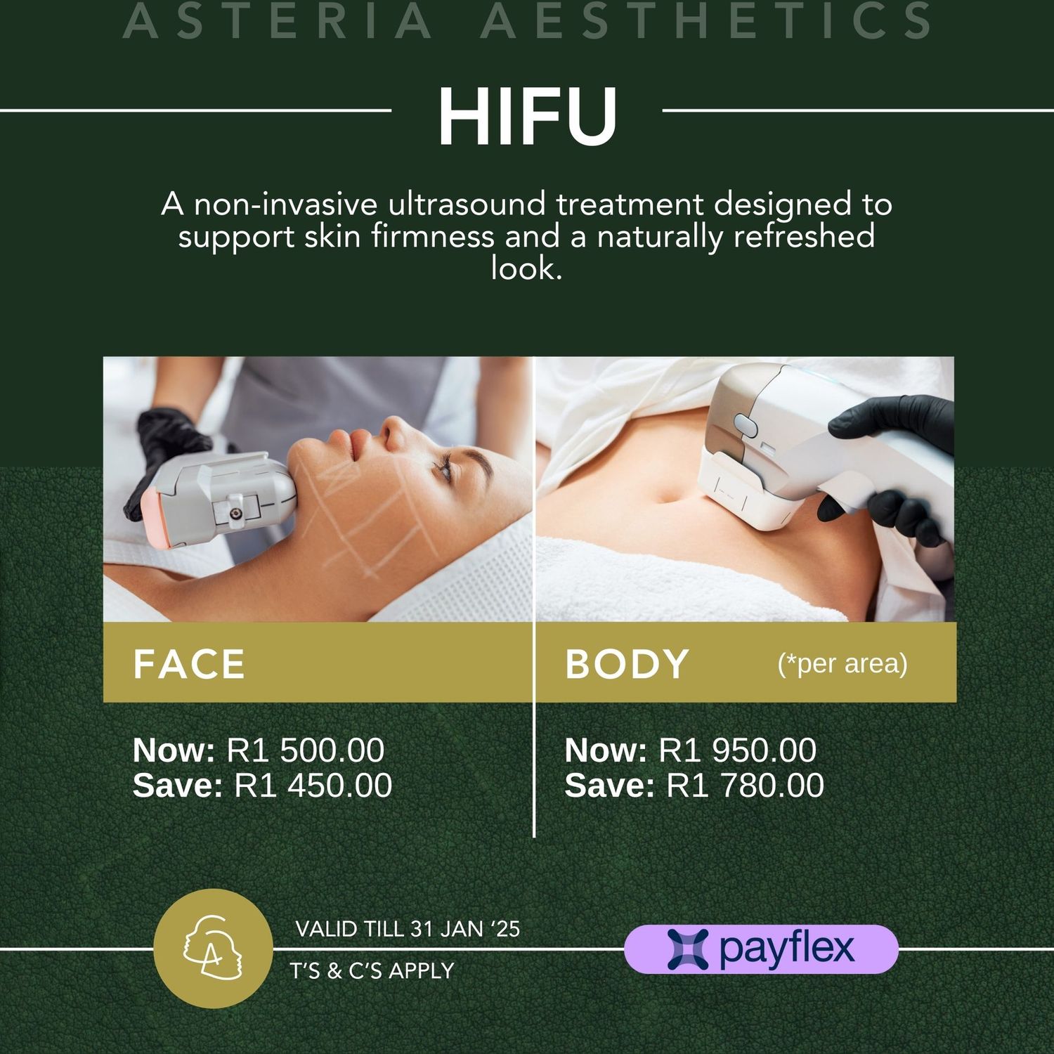 HIFU Body (*per area)