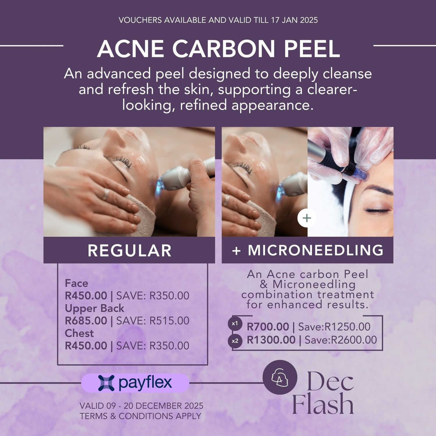 Carbon Peeling Laser Treatment + Microneedling Face