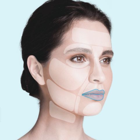ThreadLift Lip Top + Bottom