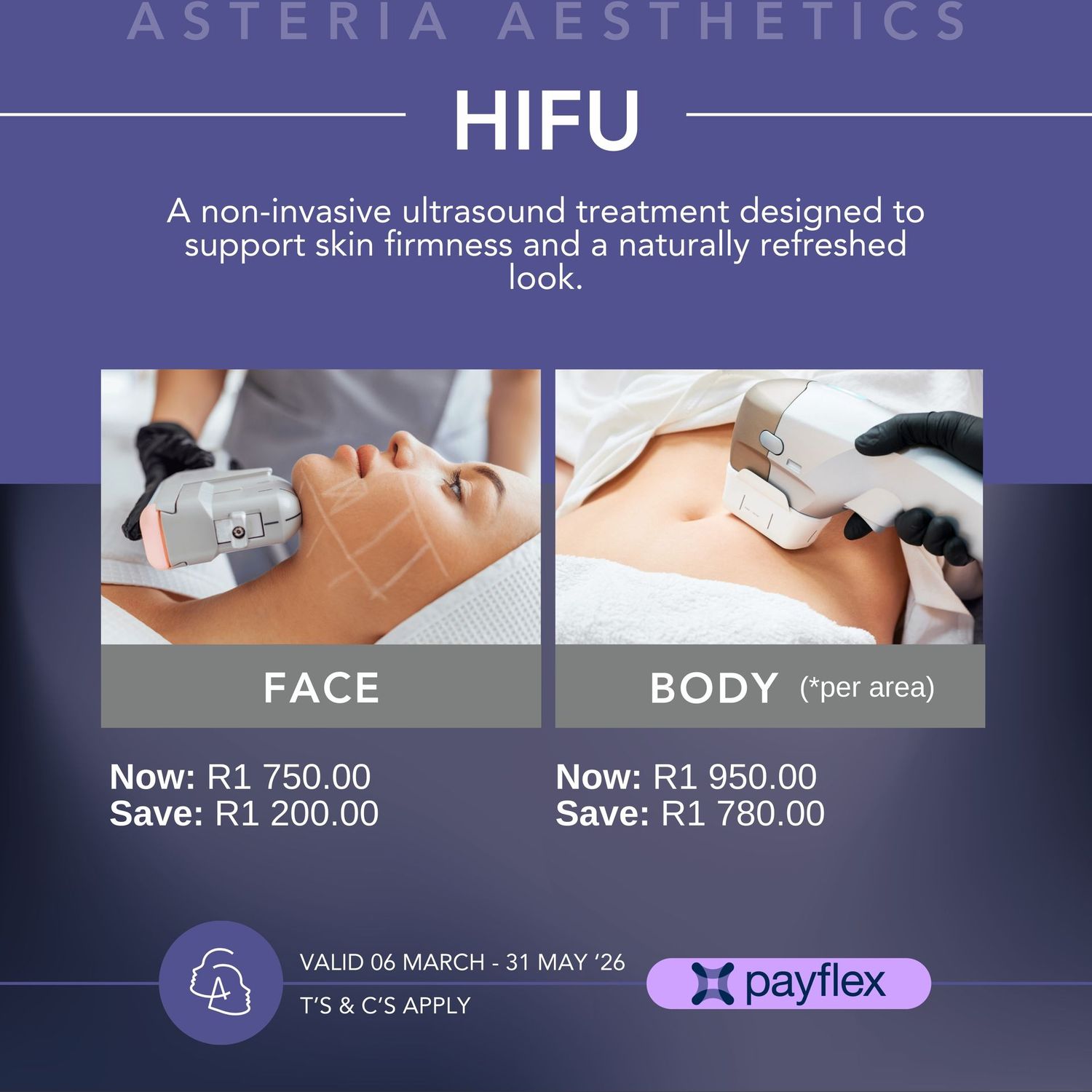 HIFU Body (*per area)