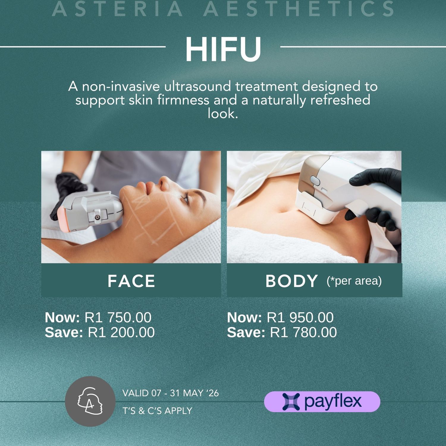 HIFU Body (*per area)